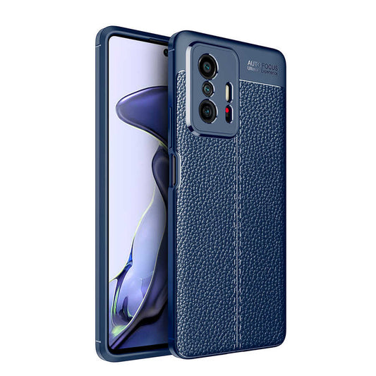 Xiaomi Mi 11T 5G Kılıf Zore Niss Silikon Kapak