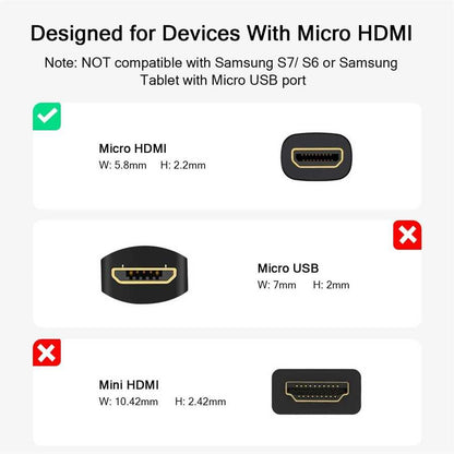 Qgeem QG-HD21 Micro HDMI Kablo Siyah