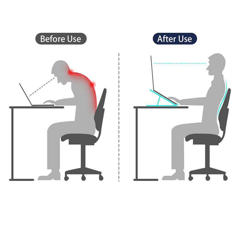 Wiwu S400 Laptop Standı Gümüş