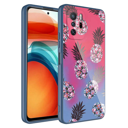 Xiaomi Redmi Note 10 Pro Kılıf Kamera Korumalı Desenli Sert Silikon Zore Epoksi Kapak